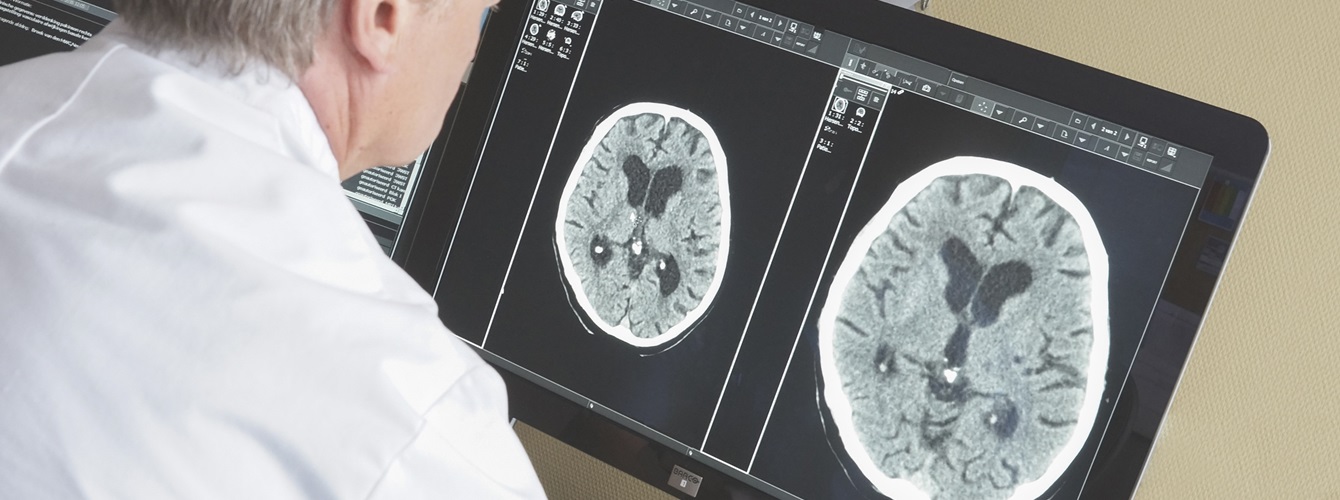 Radiologie CT - St Jansdal Radiologie CT - St Jansdal